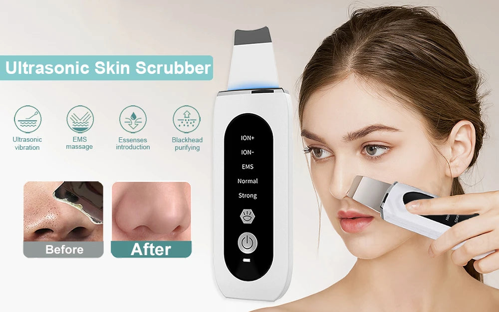 Ultrasonic Skin Scrubber with Microcurrent & LED Therapy – Deep Pore Cleansing, Blackhead Removal, Skin Rejuvenation, Negative Ion Technology